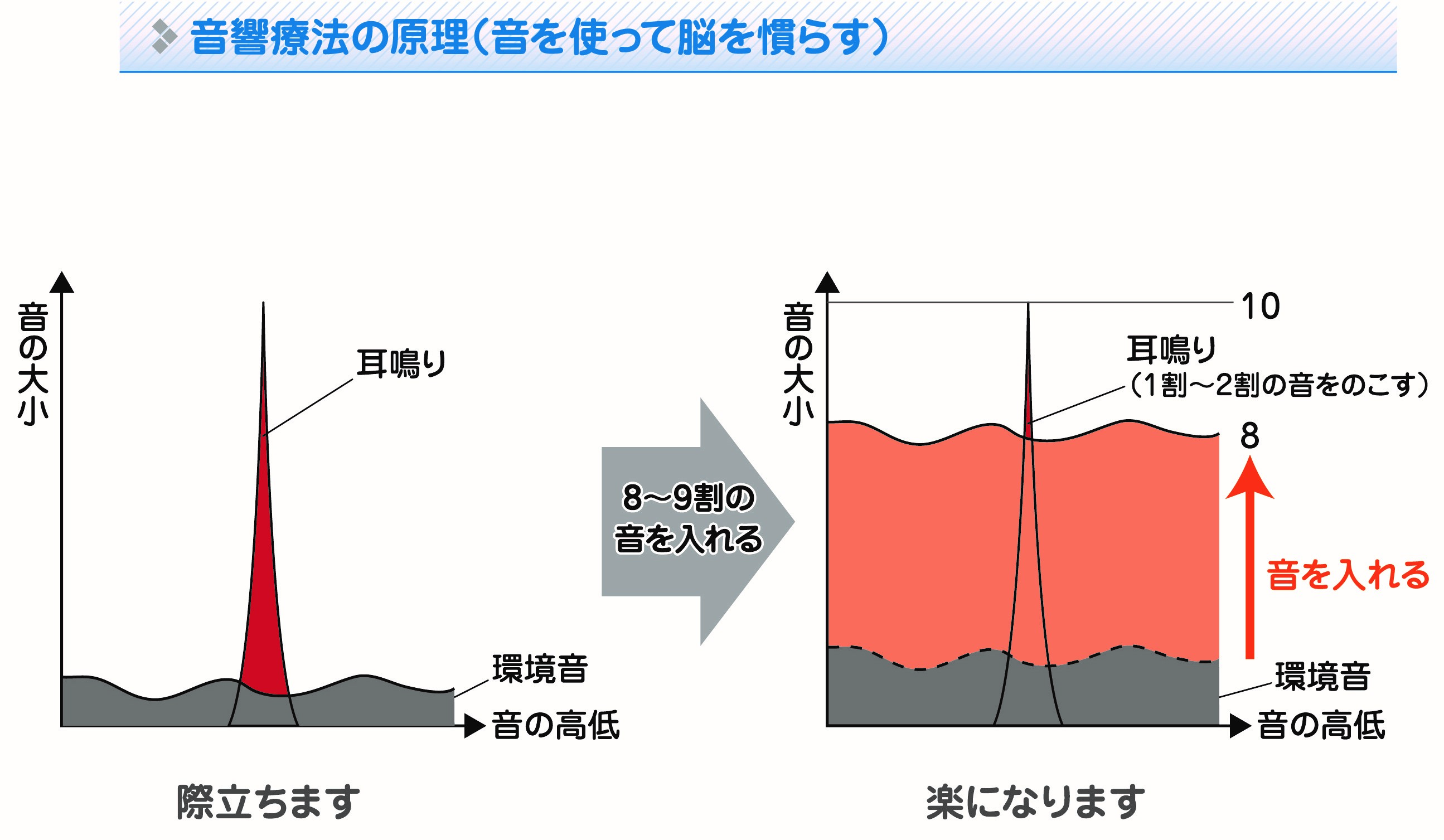 音響療法