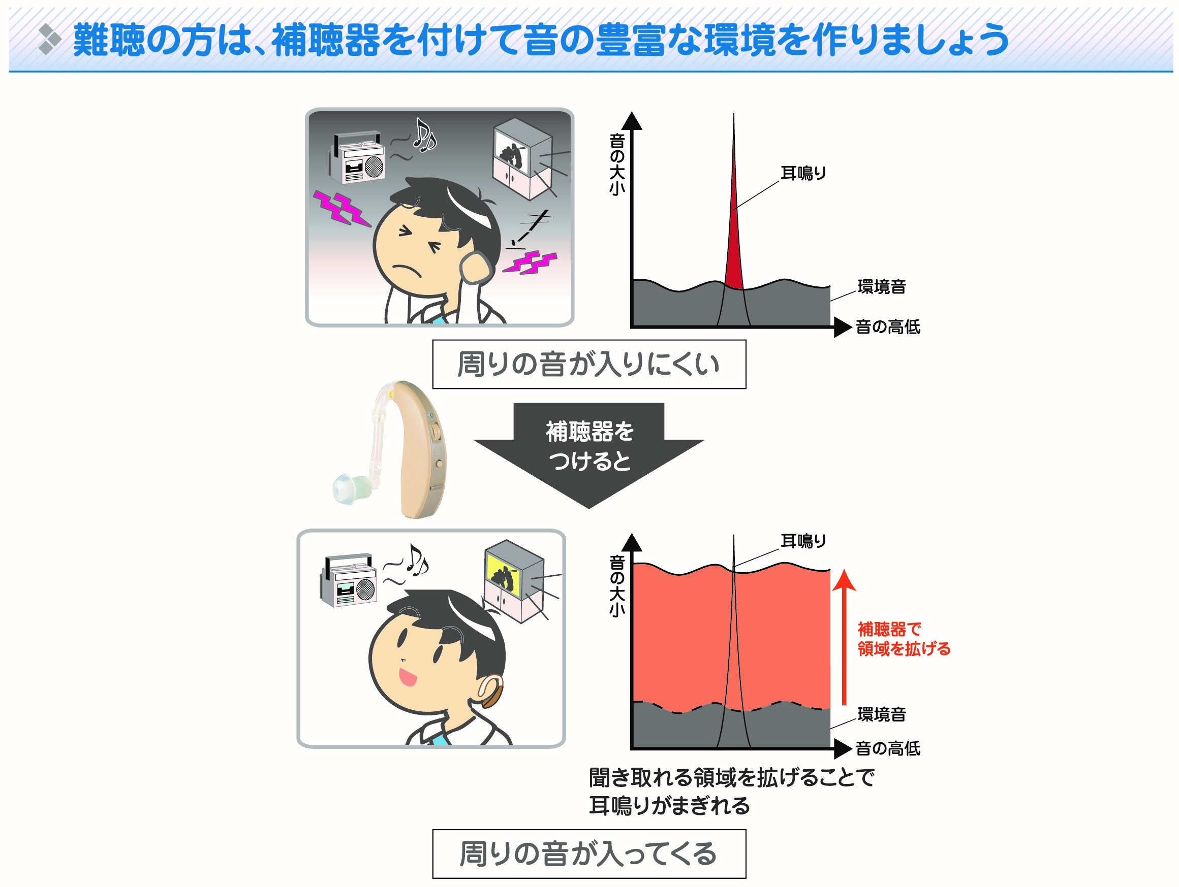 音響療法と補聴器